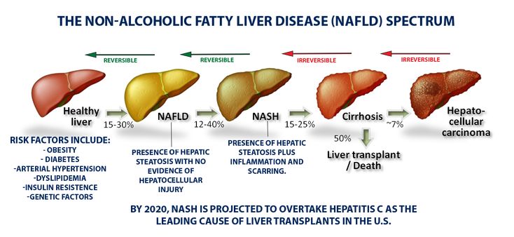 Myths About Fatty Liver Disease You Probably Believe