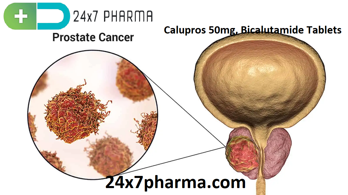 Calupros 50mg, Bicalutamide Tablets