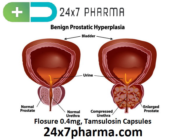 Flosure 0.4mg, Tamsulosin Capsules